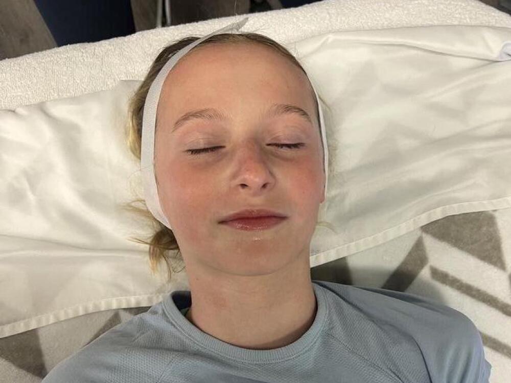 HydraFacial adolescent peau éclatante — Institut V Esthétique Montréal