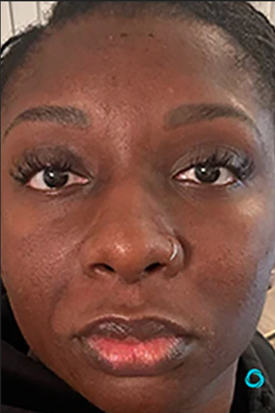 Avant &mdash; Teint irr&eacute;gulier